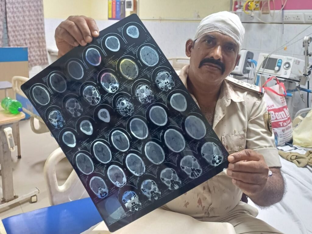 बोधगया में नशे में धुत बारातियों ने मचाया तांडव: दरोगा को पीटकर किया लहूलुहान, महिला सिपाही ने नदी में भागकर बचाई जान, ड्राइवर गाड़ी लेकर फरार 10 img 20250505 wa00225222578434023253477 बोधगया में नशे में धुत बारातियों ने मचाया तांडव: दरोगा को पीटकर किया लहूलुहान, महिला सिपाही ने नदी में भागकर बचाई जान, ड्राइवर गाड़ी लेकर फरार