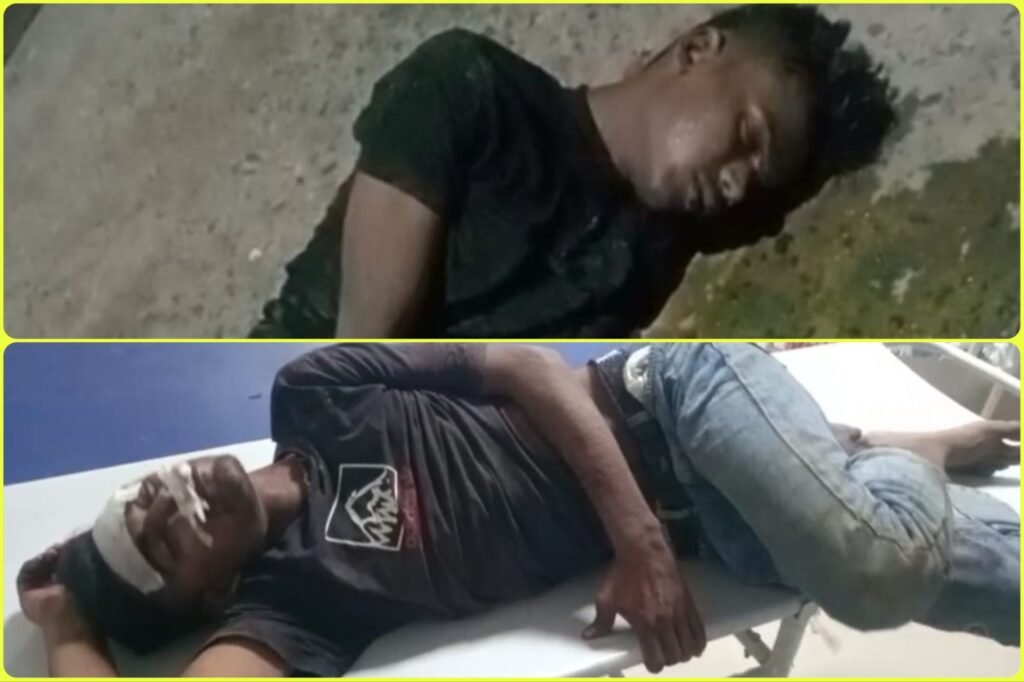 लूट की वारदात को अंजाम देकर भाग रहे दो अपराधी सड़क हादसे में घायल, कट्टा और लूटा मोबाइल बरामद