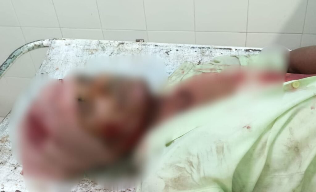 औरंगाबाद में तेज रफ्तार बाइक ने सब्जी विक्रेता को मारी टक्कर, तीन घायल, एक की हालत नाज़ुक